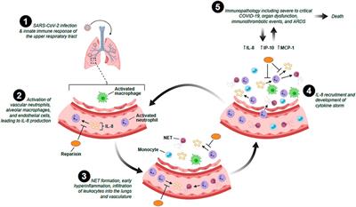 The Role of Interleukin-8 in Lung Inflammation and Injury: Implications for the Management of COVID-19 and Hyperinflammatory Acute Respiratory Distress Syndrome